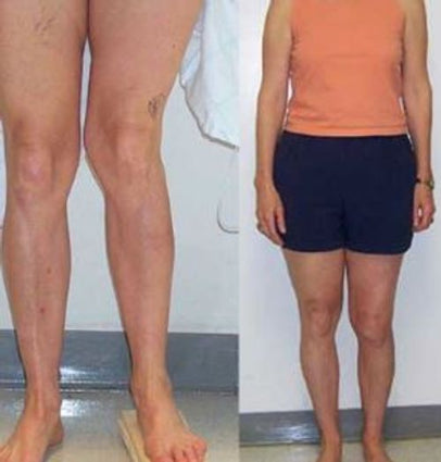 Diystar® SilverRelief Joint Therapy Gel