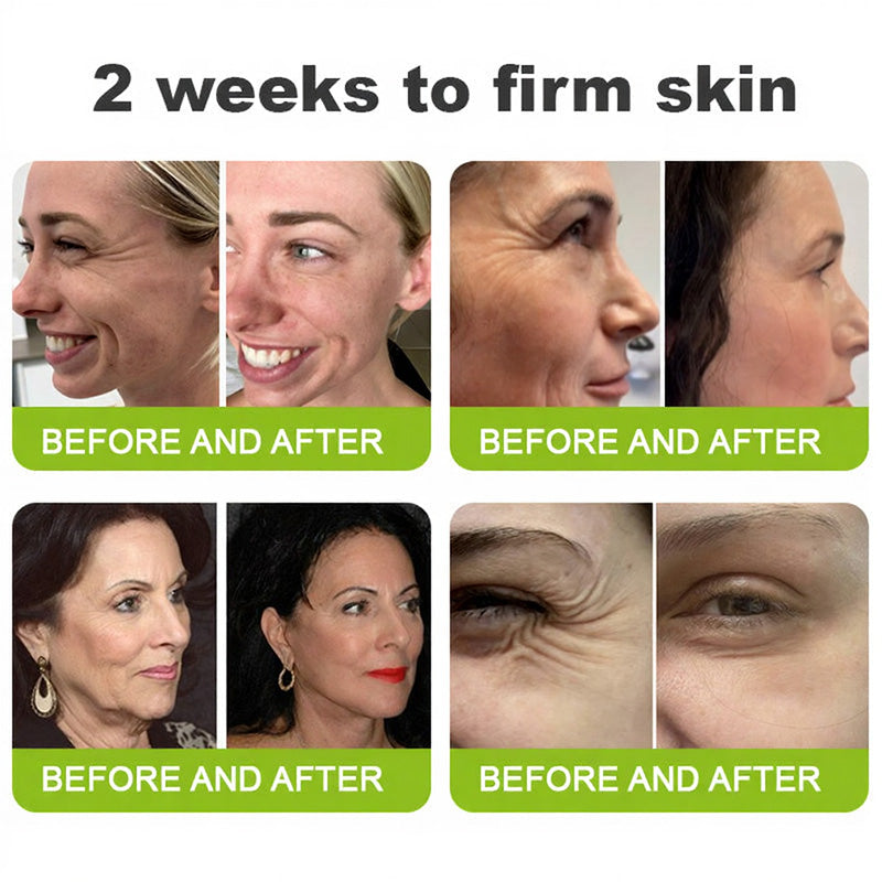 🧠👨‍⚕️Made and shipped from the USA 💫Lovilds® Botin & Vita-A Retinol Shot Wrinkle-Lift Tightening cream - Last Day Promotion 50% OFF