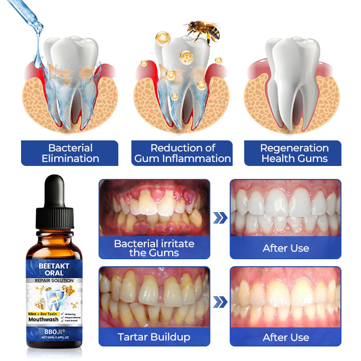 BBOJI® BeeTakt Oral Repair Solution