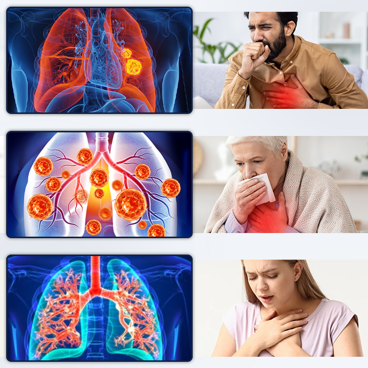 Medazy® PureBreath Lung Support Patch