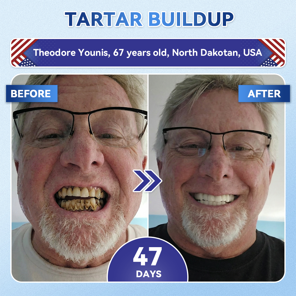 Grunsify® 🦷 Tideglusib Fast‑Dissolving Tooth & Gum Repair Oral Strips ✨