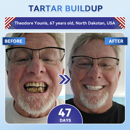Grunsify® 🦷 Tideglusib Fast‑Dissolving Tooth & Gum Repair Oral Strips ✨