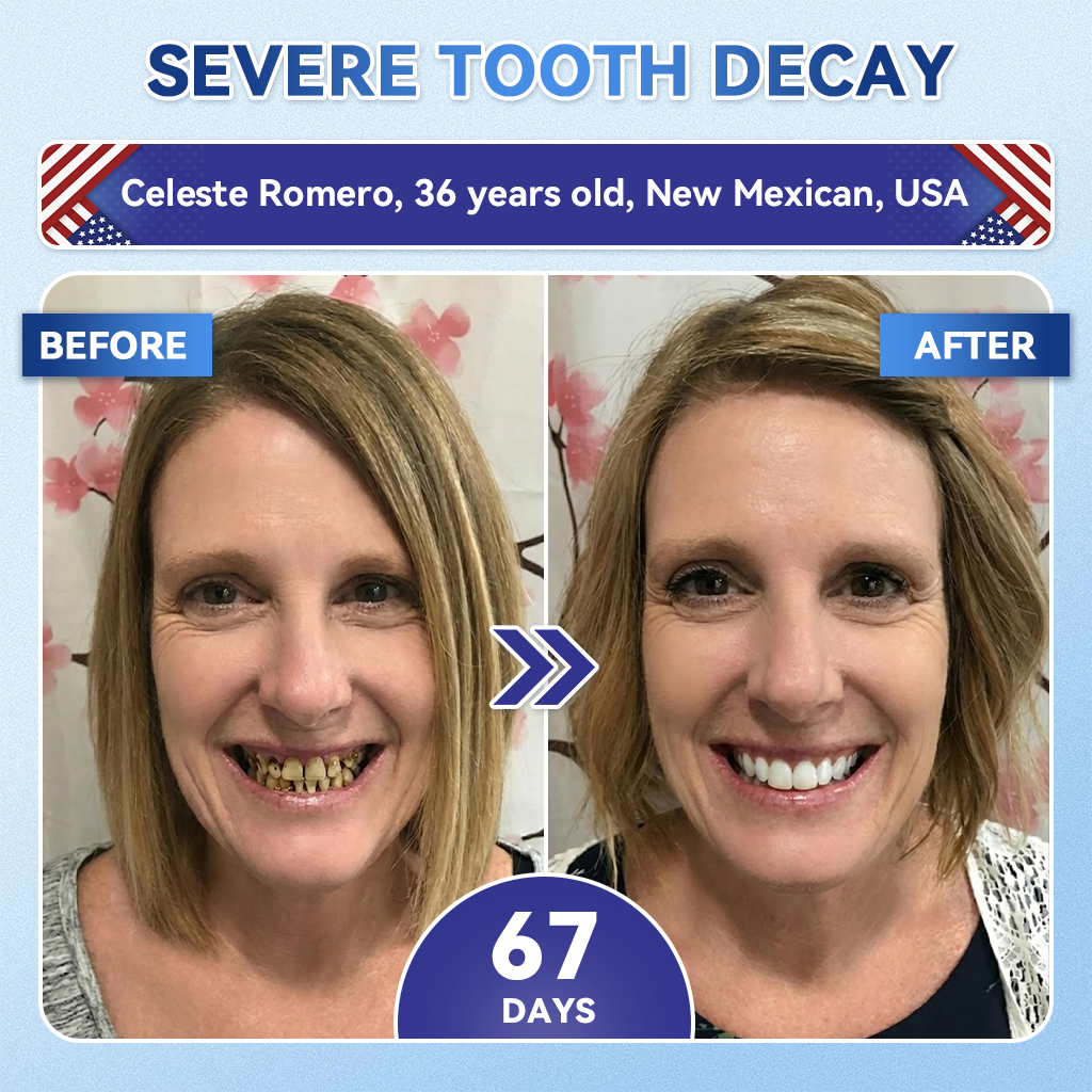 Grunsify® 🦷 Tideglusib Fast‑Dissolving Tooth & Gum Repair Oral Strips ✨