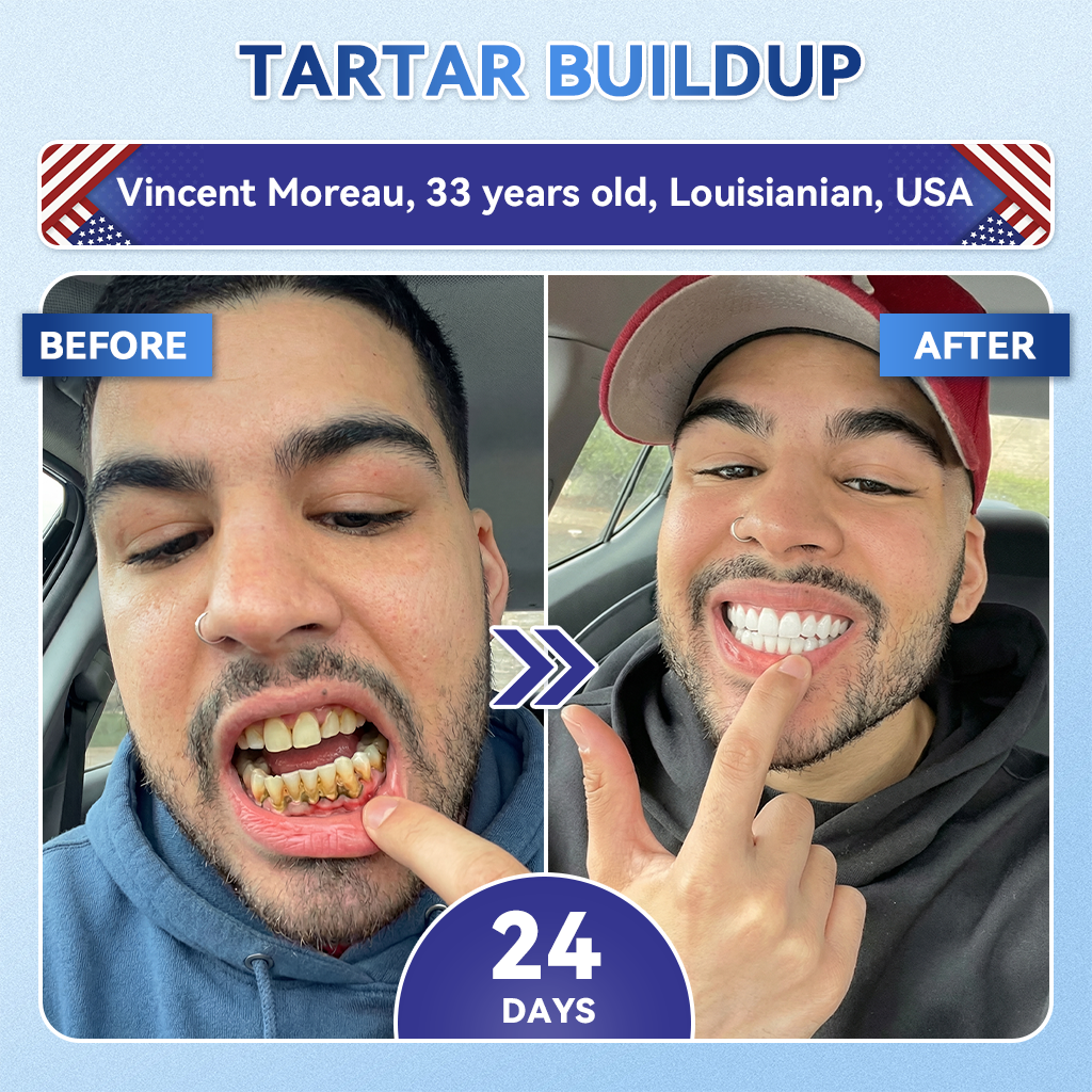 Grunsify® 🦷 Tideglusib Fast‑Dissolving Tooth & Gum Repair Oral Strips ✨