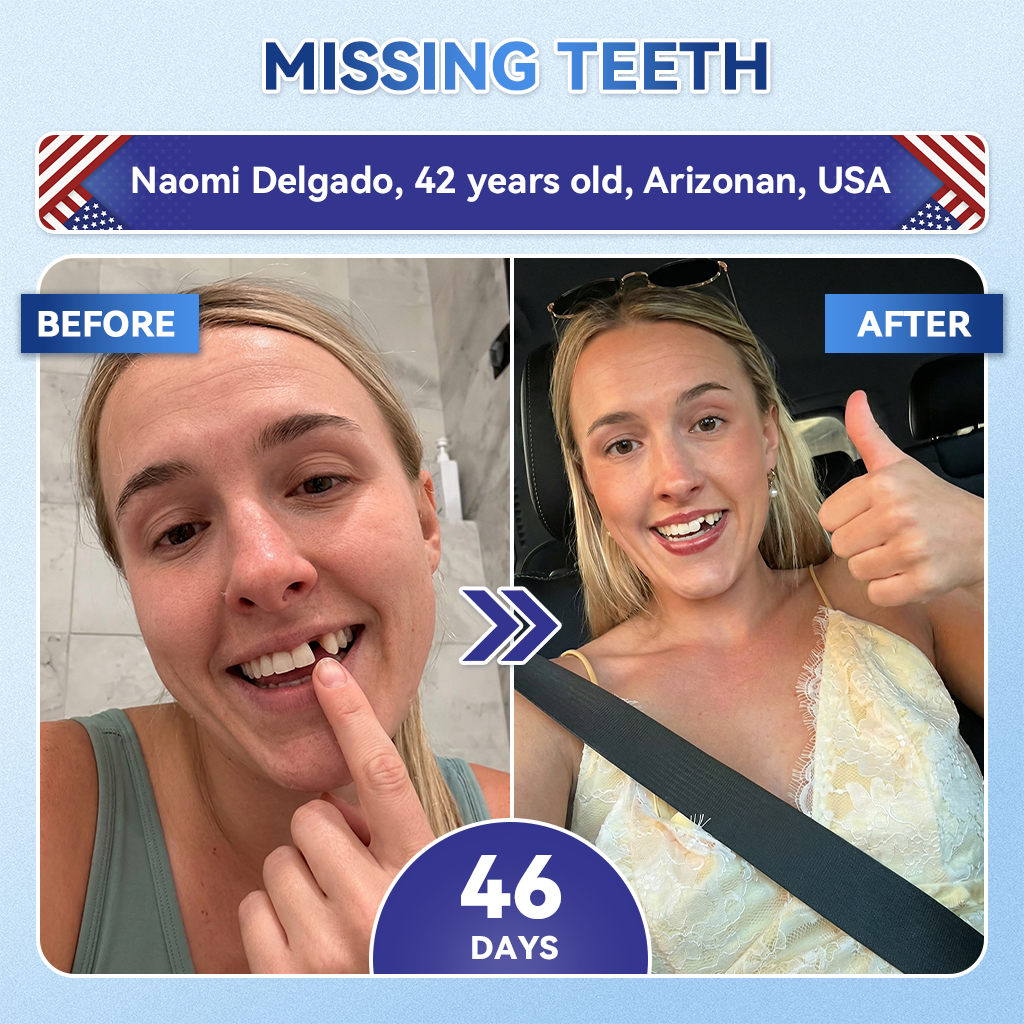 Grunsify® 🦷 Tideglusib Fast‑Dissolving Tooth & Gum Repair Oral Strips ✨