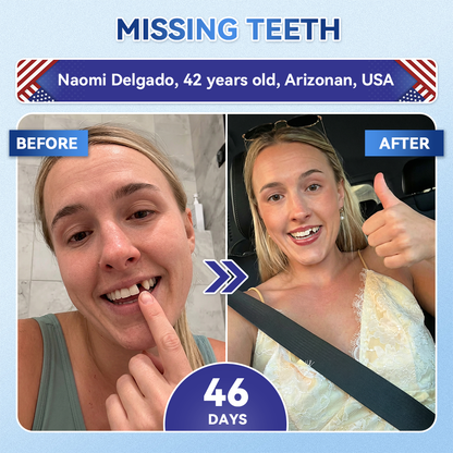 Grunsify® 🦷 Tideglusib Fast‑Dissolving Tooth & Gum Repair Oral Strips ✨