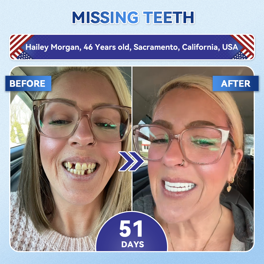 Grunsify® 🦷 Tideglusib Fast‑Dissolving Tooth & Gum Repair Oral Strips ✨