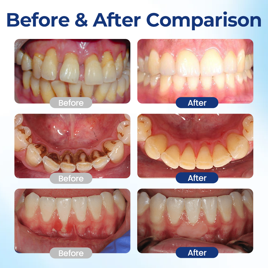 BBOJI® BeeTakt Oral Repair Solution
