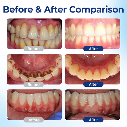 BBOJI® BeeTakt Oral Repair Solution
