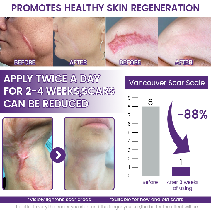 Medazy® ReGenScar Stem Cell Scar Gel