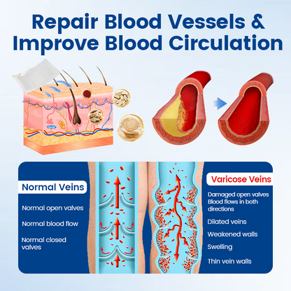 👨‍⚕️🔥Diystar® VeinEase Microneedle Care Patch⚡Instant Relief, Long-Term Results