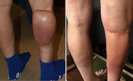 Diystar® SilverRelief Joint Therapy Gel