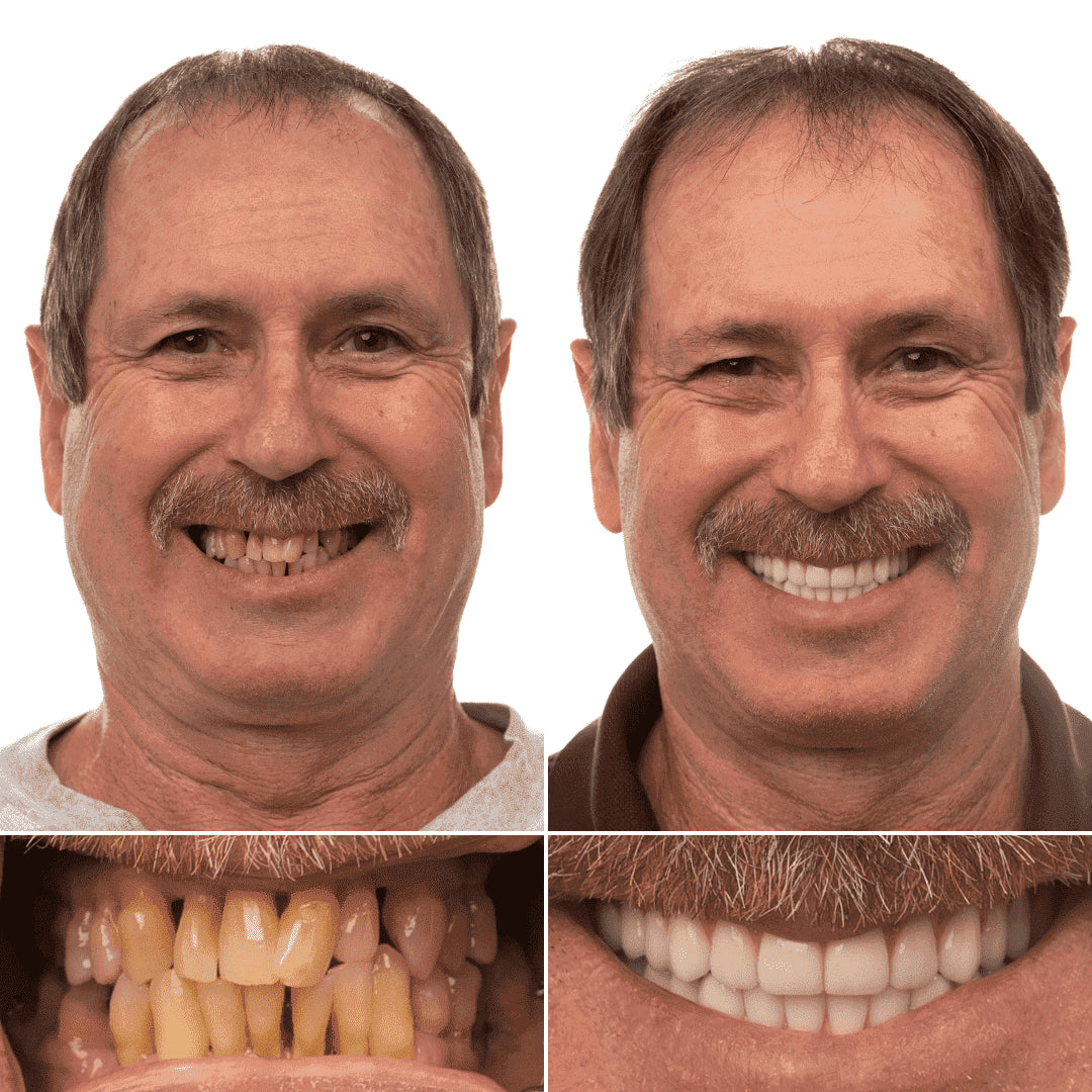 Qooes™ Niacinamide Whitening Toothpaste