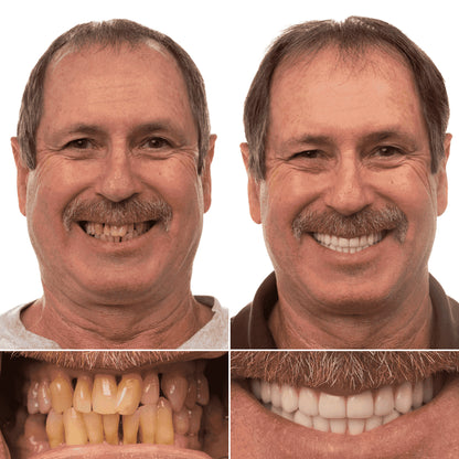 Qooes™ Niacinamide Whitening Toothpaste